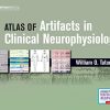 Atlas of Artifacts in Clinical Neurophysiology (PDF)