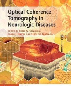 Optical Coherence Tomography in Neurologic Diseases