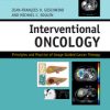 Interventional Oncology Principles and Practice of Image-Guided Cancer Therapy, 2nd Edition (Retail PDF)