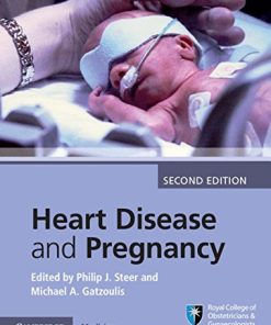 Heart Disease and Pregnancy, 2nd Edition