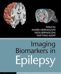 Imaging Biomarkers in Epilepsy (PDF)
