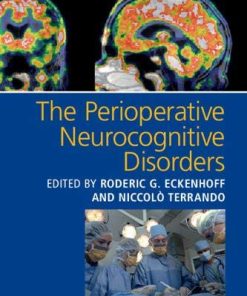 The Perioperative Neurocognitive Disorders (PDF)