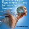 Local and Regional Flaps in Head and Neck Reconstruction: A Practical Approach (Videos+PPT)