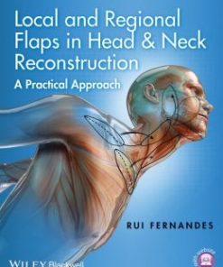 Local and Regional Flaps in Head & Neck Reconstruction: A Practical Approach (PDF)