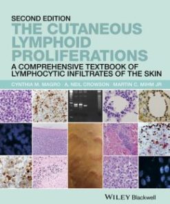 The Cutaneous Lymphoid Proliferations: A Comprehensive Textbook of Lymphocytic Infiltrates of the Skin, 2nd Edition
