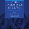 Schiff’s Diseases of the Liver, 12th Edition (EPUB)