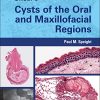 Shear’s Cysts of the Oral and Maxillofacial Regions, 5th Edition (PDF)