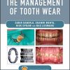 Practical Procedures in the Management of Tooth Wear (PDF Book)