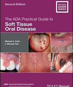 The ADA Practical Guide to Soft Tissue Oral Disease (PDF)