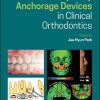 Temporary Anchorage Devices in Clinical Orthodontics (PDF)