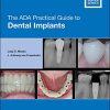 The ADA Practical Guide to Dental Implants (PDF)