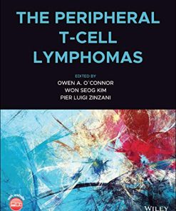 The Peripheral T-Cell Lymphomas (PDF)