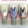 Clinical and Laboratory Manual of Dental Implant Abutments (PDF)