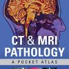 CT & MRI Pathology: A Pocket Atlas, Third Edition (EPUB)