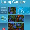 Lung Cancer: Standards of Care (High Quality PDF)