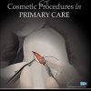 Dermatologic Surgery and Cosmetic Procedures in Primary Care Practice (PDF Book)