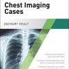Critical Concept Mastery Series: Chest Imaging Cases (PDF)
