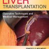 Liver Transplantation: Operative Techniques and Medical Management (High Quality PDF)
