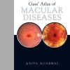 Gass’ Atlas of Macular Diseases: 2-Volume Set, 5th Edition