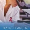 Breast Cancer Facts, Myths, and Controversies: Understanding Current Screenings and Treatments (PDF)