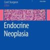 Endocrine Neoplasia (EPUB)