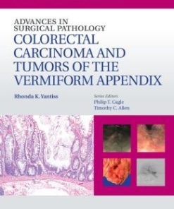 Advances in Surgical Pathology: Colorectal Carcinoma and Tumors of the Vermiform Appendix (PDF)