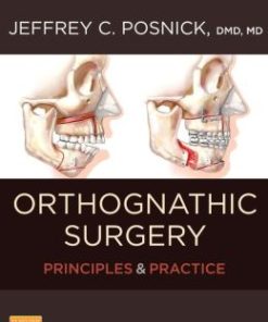 Orthognathic Surgery – 2 Volume Set: Principles and Practice (PDF)