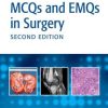 MCQs and EMQs in Surgery: A Bailey and Love Revision Guide, Second Edition