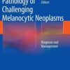 Pathology of Challenging Melanocytic Neoplasms: Diagnosis and Management (PDF)
