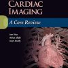 Cardiac Imaging: A Core Review (EPUB)