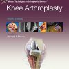 Master Techniques in Orthopedic Surgery: Knee Arthroplasty, 4th Edition (PDF)