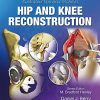 Illustrated Tips and Tricks in Hip and Knee Reconstructive and Replacement Surgery (EPUB)