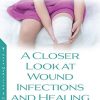 A Closer Look at Wound Infections and Healing (New Developments in Medical Research) (PDF)