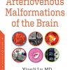 Arteriovenous Malformations of the Brain (PDF)