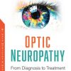 Optic Neuropathy: From Diagnosis to Treatment (PDF)