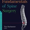 The Fundamentals of Spine Surgery (PDF)