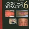 Fisher’s Contact Dermatitis, 6th Edition (PDF)