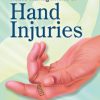 Acute Management of Hand Injuries (PDF)