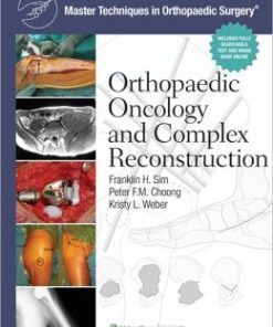 Master Techniques in Orthopaedic Surgery: Orthopaedic Oncology and Complex Reconstruction (PDF)
