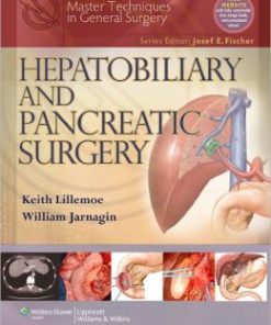 Master Techniques in Surgery: Hepatobiliary and Pancreatic Surgery (PDF)