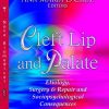Cleft Lip and Palate: Etiology, Surgery & Repair and Sociopsychological Consequences (Congenital Disorders – Laboratory and Clinical Research) (PDF)