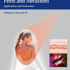 Lasers and Light, Peels and Abrasions: Applications and Treatments (PDF)