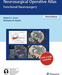 Neurosurgical Operative Atlas: Functional Neurosurgery (PDF)