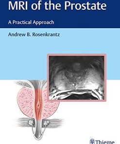 MRI of the Prostate: A Practical Approach (EPUB)