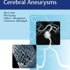 Brain Arteriovenous Malformations and Arteriovenous Fistulas (EPUB)