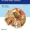 Comprehensive Management of Skull Base Tumors, 2nd Edition (PDF Book + Videos)