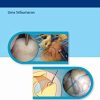 Video Atlas of Arthroscopic Rotator Cuff Repair (PDF Book + Videos)