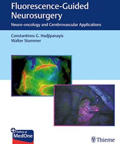 Fluorescence-Guided Neurosurgery: Neuro-oncology and Cerebrovascular Applications (PDF+Videos)