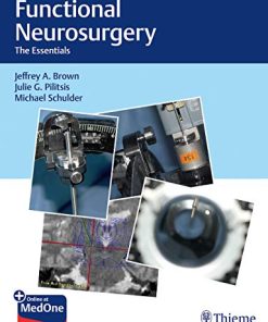 Functional Neurosurgery: The Essentials (PDF)