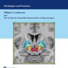 Deep Brain Stimulation: Techniques and Practices (PDF)